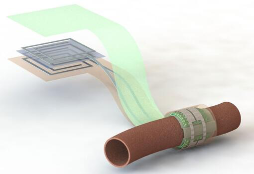上圖描繪了這款可生物降解的壓力傳感器，它圍繞著一根血管，天線(xiàn)在左側(cè)(分離的層狀結(jié)構(gòu)，展示了天線(xiàn)結(jié)構(gòu)的細(xì)節(jié))